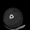 SPORK, NICO - 22.03.1976 - 02.08.2022 - CT obere Extremität - 17:51:17